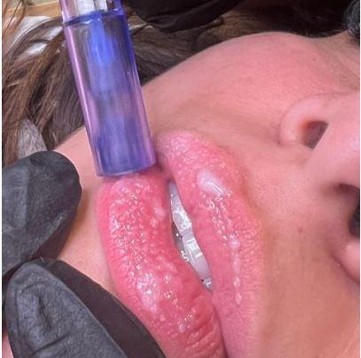Hidra Gloss